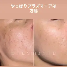 《都度払い》土台を整えて肌を育てる✨