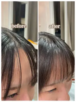 前髪ヘアリセッター