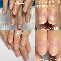 ハンドネイル爪周り甘皮、角質ケア