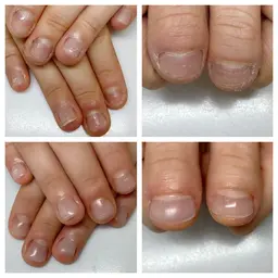 💅《深爪・噛み爪の方へ》🌟深爪矯正＋長さ出し10本《カウンセリング付き》