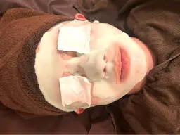 お顔のたるみが気になる方必見‼️（リフトアップ）