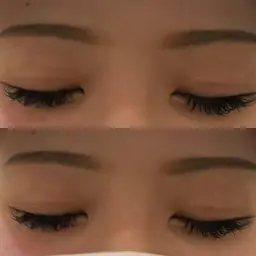 シングルラッシュ👀100本