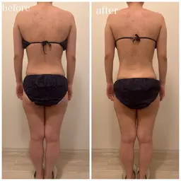 【5名様限定】ハイパーナイフモニター（お背中・肩甲骨・腰回り20分）