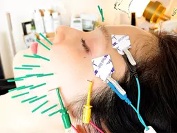 📸EMS美容鍼モニター募集📸必ず下記の詳細情報をよくお読みの上リクエストして下さい