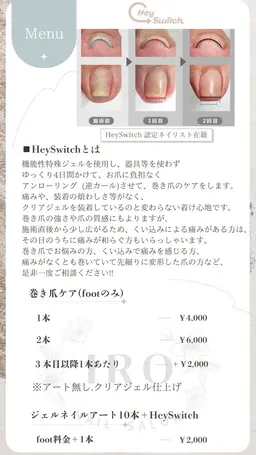 巻き爪ケア1本(クリアジェル仕上げ)