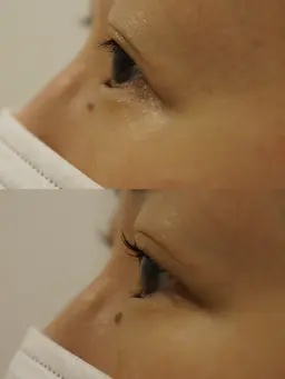 【一重、奥二重で下がりまつ毛の方】トリートメント付まつ毛パーマ✨