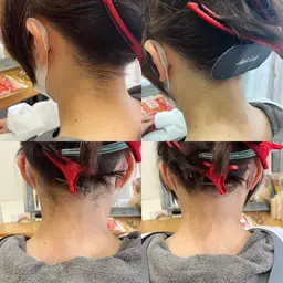 11/30まで限定♡ネープデザイン脱毛(うなじ/襟足脱毛)