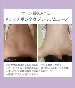 ❣️ボディリンパエステ❣️辛いコリに効果抜群のリンパケア❣️不要物排出ジェルを使用し要らないものをグングン出してスッキリ
