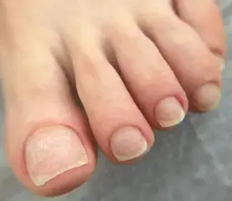 フットケア込み オフのみ
