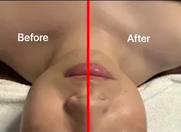 💆♀️フェイシャル💆♀️60分