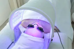 ニキビを改善したい方／症例モデル募集