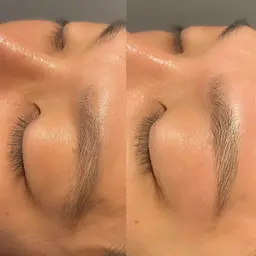 アイブロウ ワックス脱毛