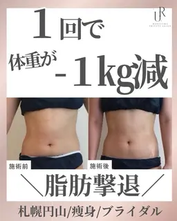 【モニター価格】🧡お腹痩身30分×初回限定モニター価格！