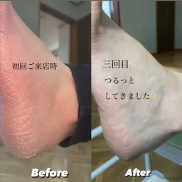 極上footケア👣【足裏角質除去】