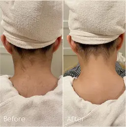 アップヘアがもっと映える✨うなじ美人ケア🪞