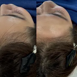 🔥ミニモ限定🔥HBL➕おでこwax🙋‍♀️口コミご協力お願いします‼️