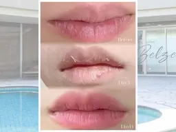 【ローマピンク🩷無料カウンセリング】