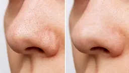 プチ体験✨毛穴吸引大掃除🧹フット&ヘッドケア➕フェイシャルケア美白シートマスク