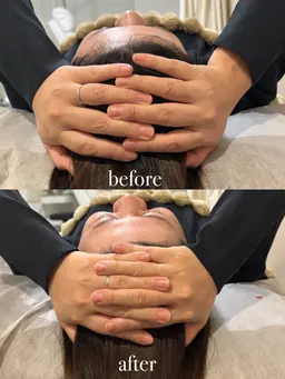 【時短コース】脳スッキリヘッド&側頭プラン🧠