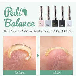 巻き爪ネイル👣