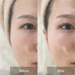 小顔フェイシャルエステ