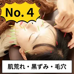 【12月限定☆ツヤ肌】美容鍼+ハーブピーリング+毛穴洗浄 ¥16,000→¥5,980