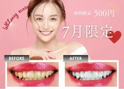 【🌸7月限定🌸】セルフホワイトニング¥3980→¥500