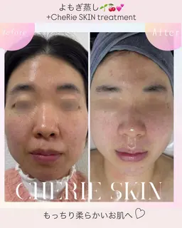 【肌診断付/全身ケア】黄土よもぎ蒸し+選べるフェイシャル《乾燥知らずもっちり艶肌》