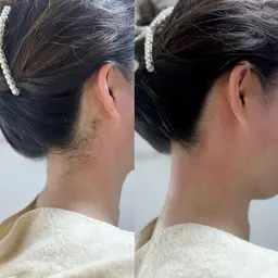 【うなじ＆もみあげWax】髪の毛を結ぶ方から大人気♪後ろ姿美人へ♪