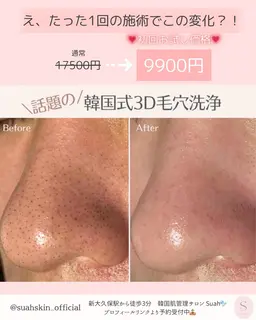 📍韓国式3D毛穴洗浄《施術直後から実感🫧 詰まり・黒ずみ・ざらつきが気になる方におすすめ✨》