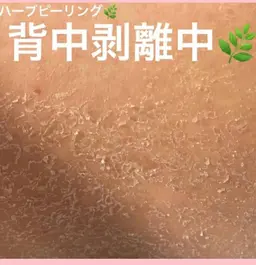 ミニモ限定‼️平日限定‼️モニター🌿Bodyハーブピーリング4980円🌿剥離あり🌿午後5時まで