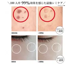 【シミ壊滅宣言🔥】最速で変わる高周波スポットケア！《シミケア》