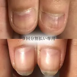 【素の爪のままピンクの部分を伸ばす】分割払い自爪育成3か月コース🎁15000円相当のホームケアセットプレゼント🎁