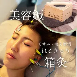 【ヘッドスパ付き❤️美容鍼＋箱灸45分】むくみ/くすみ/ほうれい線/たるみ/内臓冷え/末端冷え🎶