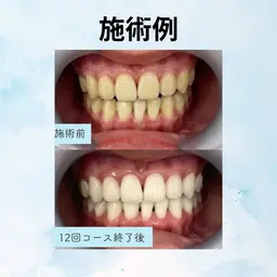 再来のお客様(美容セルフホワイトニング)