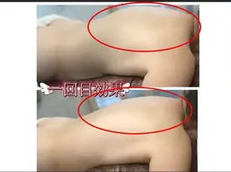 【痩身人気 No.1】インディバ痩身+全身アロマリンパマッサージ130分¥12,800