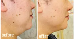 《50代からの引き締め実感》アゴ・目元・しぼみ肌ケア［初回体験］