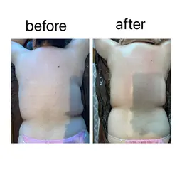 ダイエットの味方！痩身リンパトリートメント90分