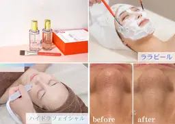 《ララピールとハイドラ》のセットメニュー🫧
