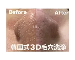 練習モデル募集🍀韓国式3D毛穴洗浄🇰🇷強い皮脂感や黒ずみ、頑固な毛穴汚れを撃退！メンズ◎人気No.1の全顔施術✨️