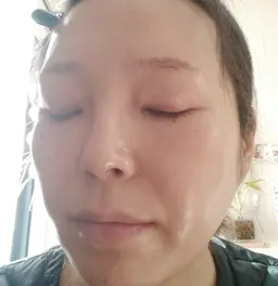 ハイドラフェイシャル+セラピール【水光肌】30代以降のお肌にハリとツヤ!ニキビ、美肌ケアにも✨️