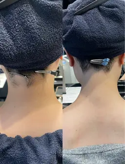 【美容室だからこそできる施術】ボブカット +うなじ脱毛✨ヘアスタイルとうなじをプロ目線でデザインします🫧シェービング込