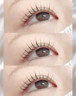 マツパ