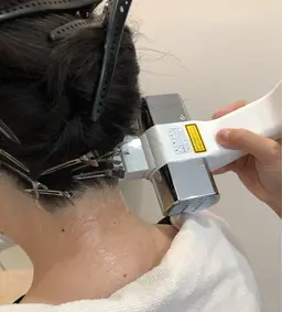 えり足脱毛またはもみあげ脱毛どちらか