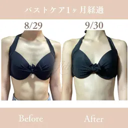 【バスト】人気No.3✨姿勢から改善♡ふわふわ美乳/バストケア/痩身