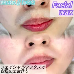 フェイシャルワックス脱毛
