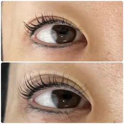 目が開くエステ⭐️Lash glow 目元エステ[まつ育コース]
