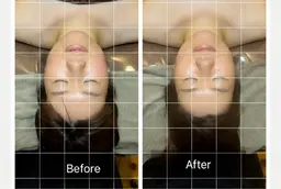 【Before After撮影可能な方、】巻き肩解消小顔コルギ＋小顔矯正50min×10回