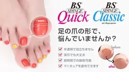 🦶巻き爪矯正🦶1本¥3500💖2本¥6500💖