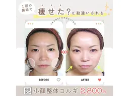 メニュー名【Google口コミ投稿お約束🌸】小顔整体コルギ 2,200円　⚠️注意事項必読